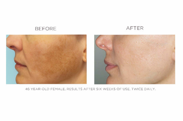Lucent - Dramatic Brightening Potion